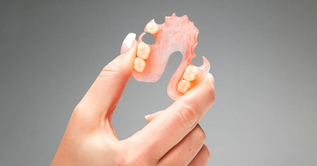 Flexible Partial Dentures for Upper Teeth: Key Benefits