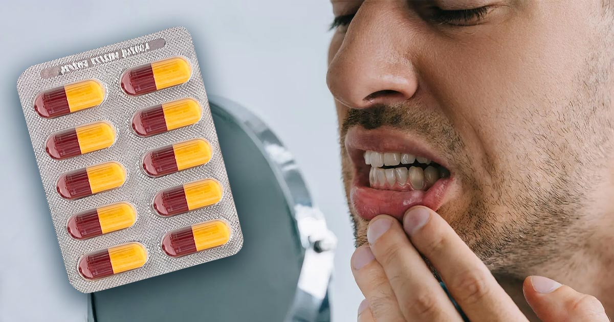 remove amoxicillin stains from teeth