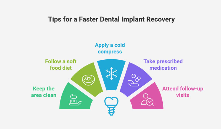 Tips for reducing dental implant pain