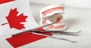 CDCP Covers Root Canals and Crowns Guide for Patients