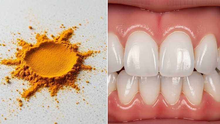 A split-screen visual showing one side with turmeric powder, and the other side showing white teeth.