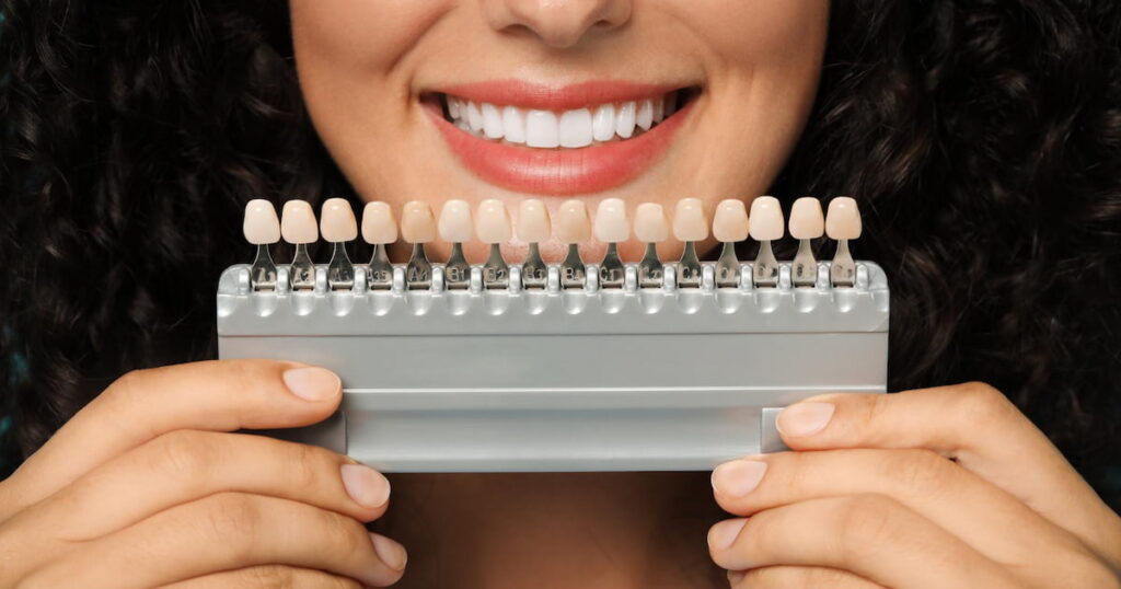 a woman is smiling and holding a set of different types of veneers in front of her teeth.