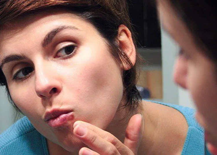 A picture of a woman examining her mouth and lips after oral surgery