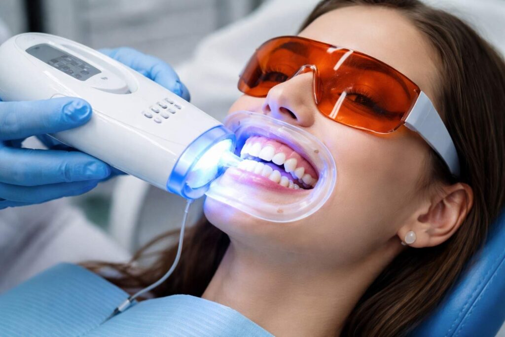how long does in-office teeth whitening last