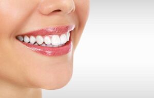 How long does teeth whitening last?