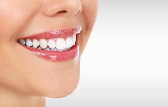 How long does teeth whitening last?