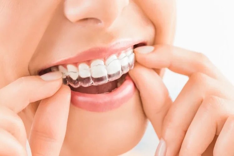 A picture of a woman putting on her invisalign