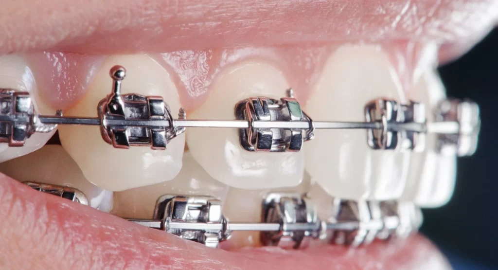 Snoring and sleep apnea are not treated the same way for everyone