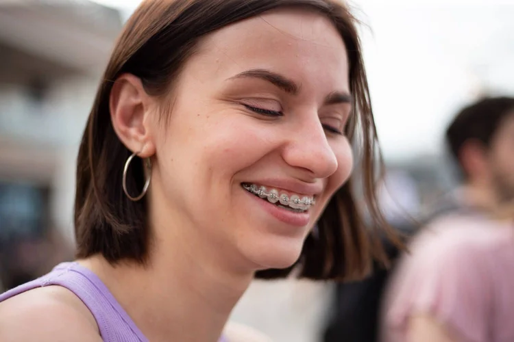 A picture of an adult with braces