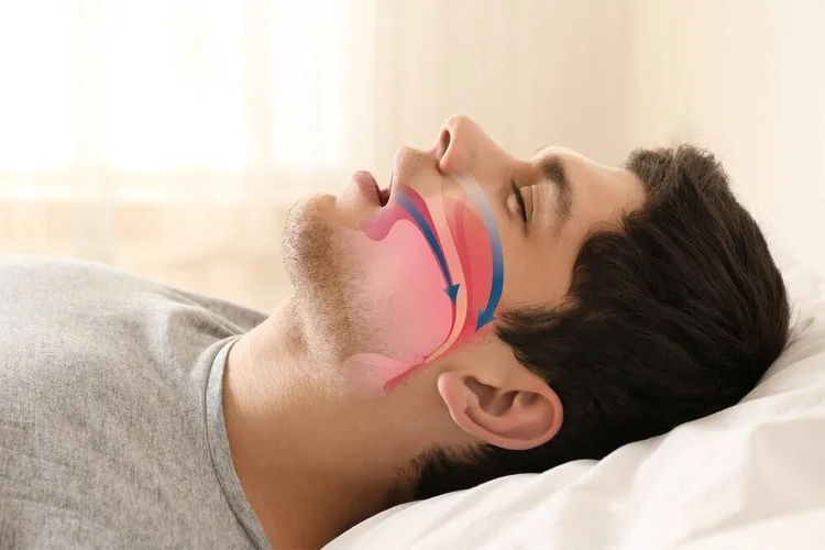 A picture representing sleep problems