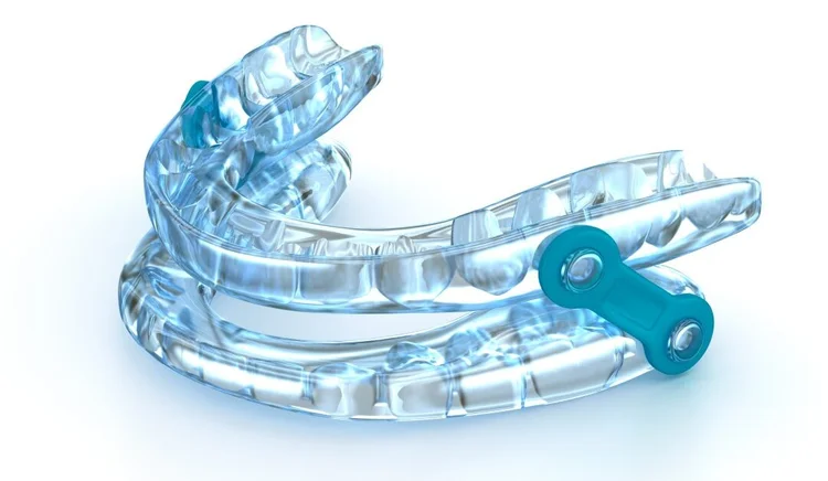 A picture of a custom mouth guard